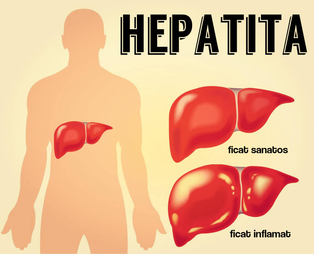 Hepatita-e-2