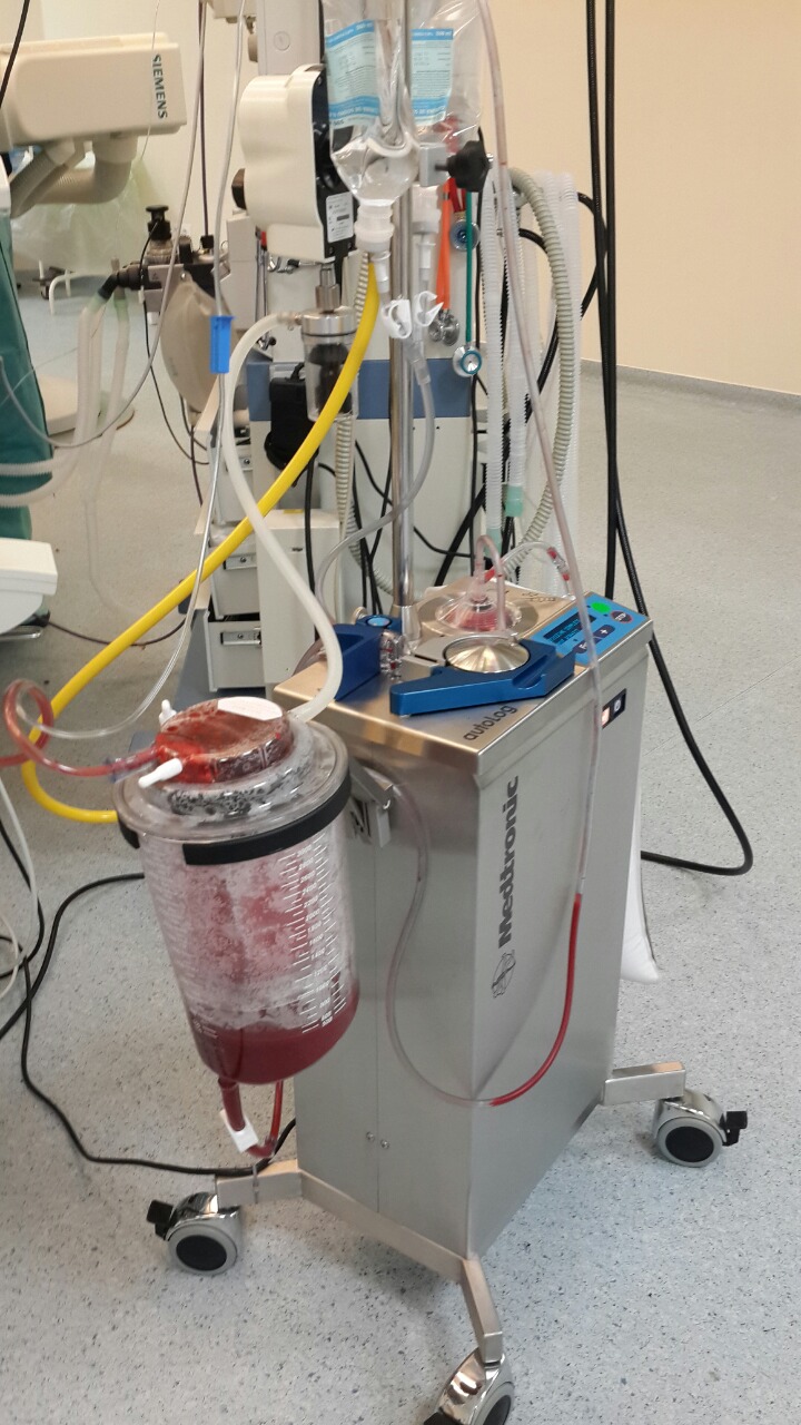aparat transfuzie
