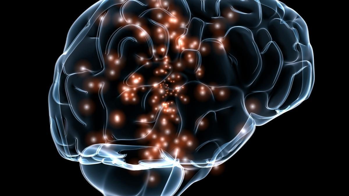 2-brain