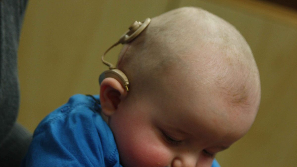 Infant_with_cochlear_implant