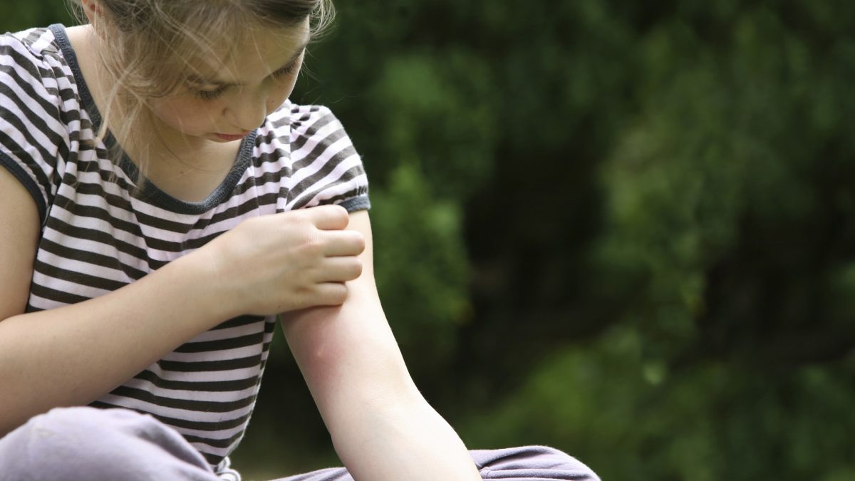 girl with mosquito bite, scratching hand has motion blur
