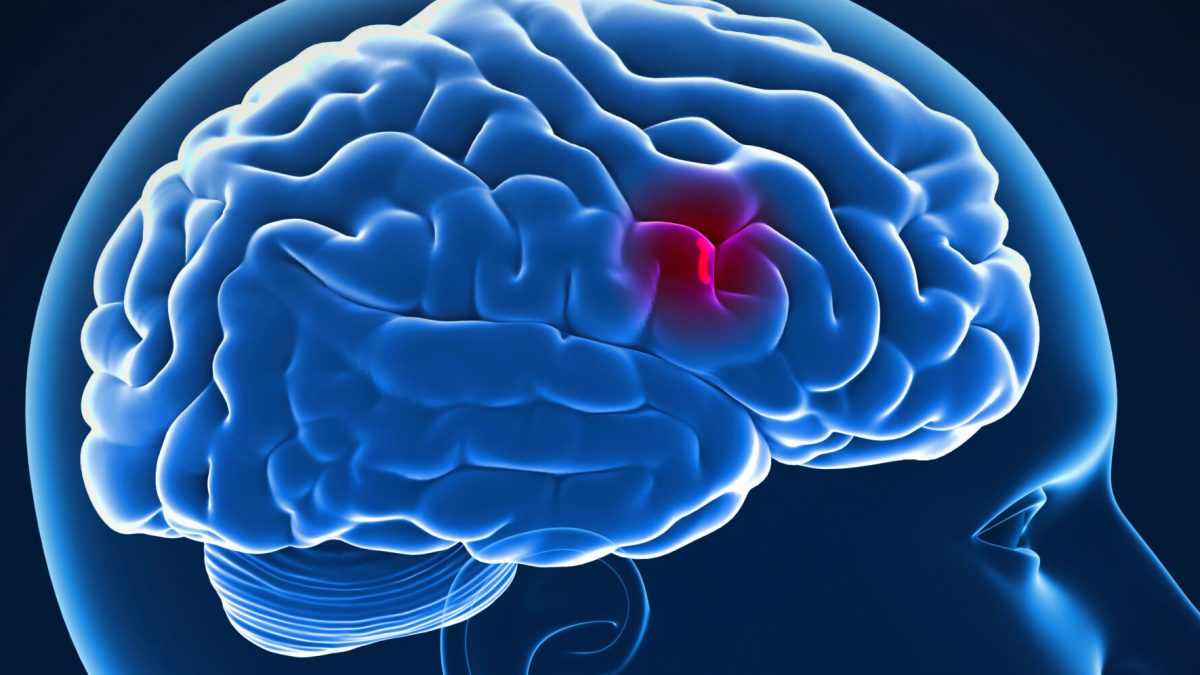 brain-good-istock_edited