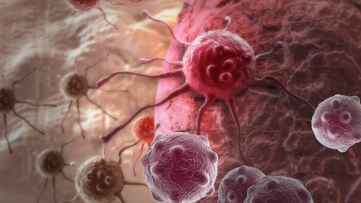 cancer-forme-tratament1