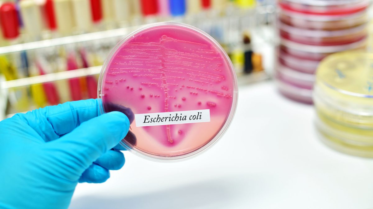 54570123 - bacteria colony of escherichia coli e.coli in culture media plate