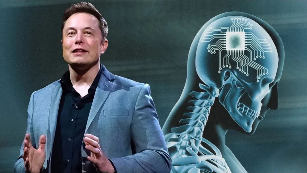 elon-musk-neuralink-1-1