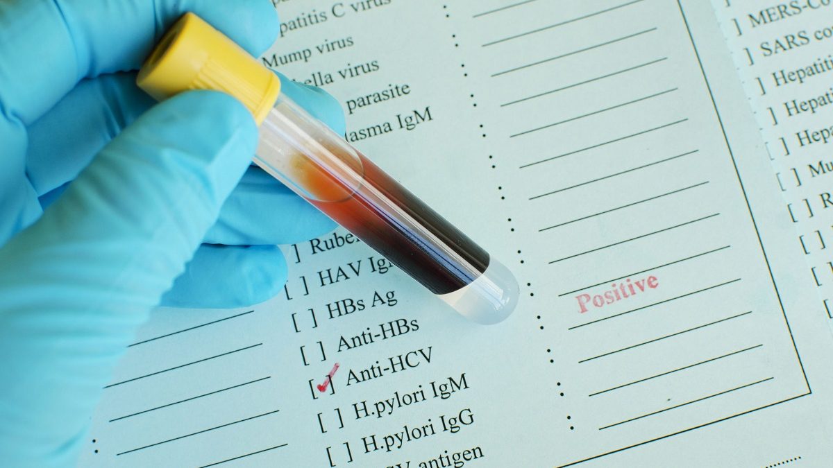 hepatita-c hepatita-c