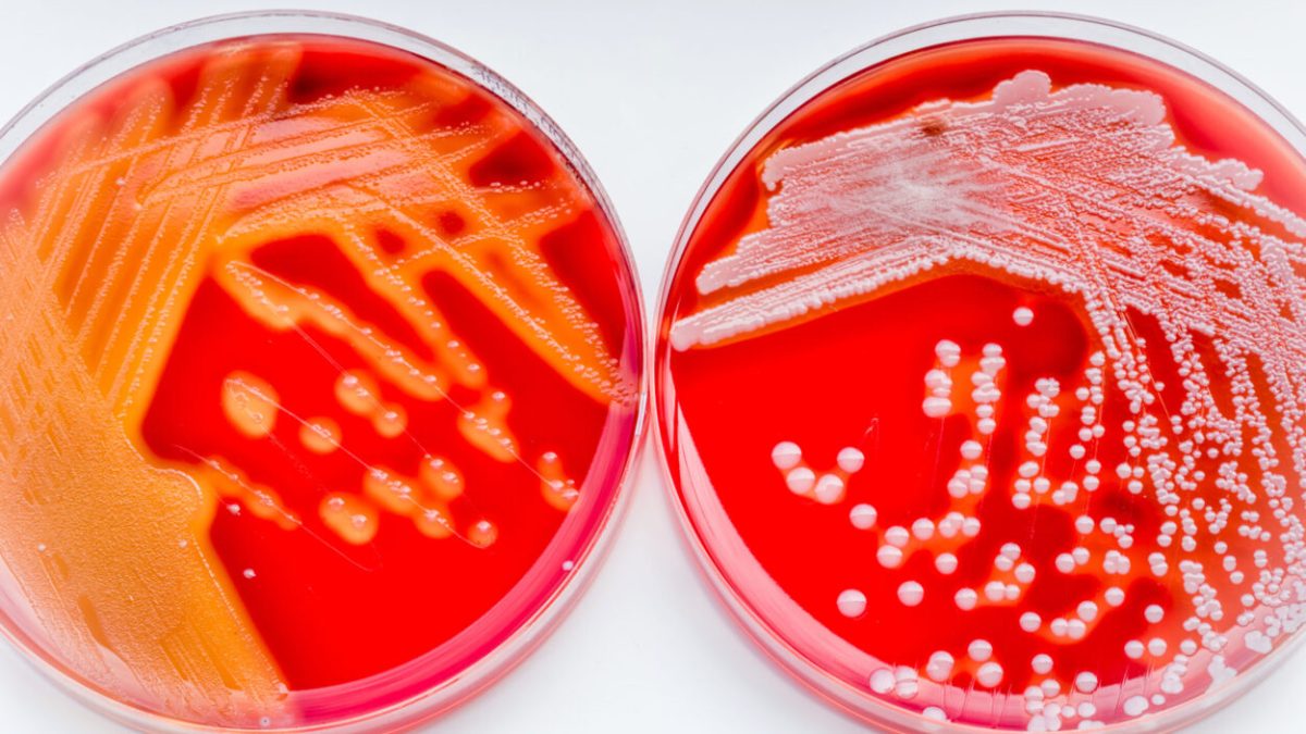 Comparison,Betaween,Staphylococcus,Aureus,And,Streptococcus,Pyogenes:,Gram-positive,Cocci,,Betahemolysis
