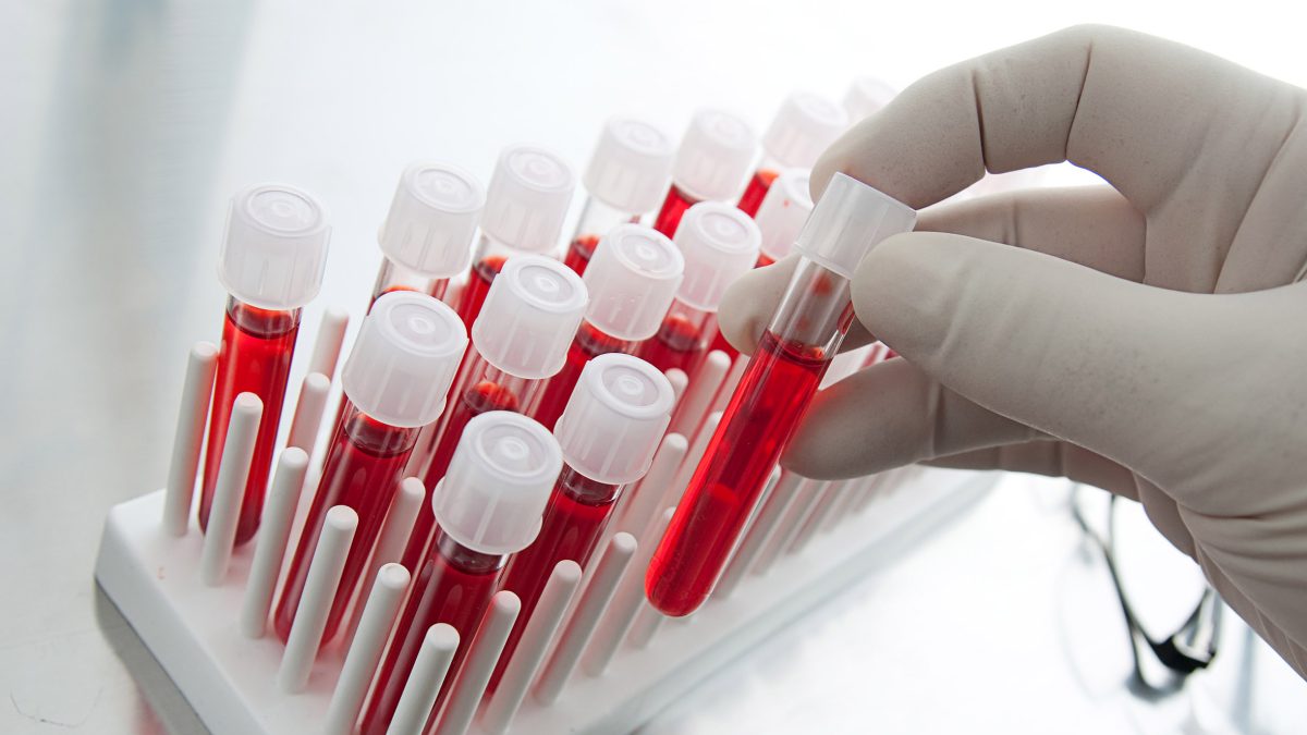 Blood samples in test-tubes